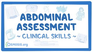 Abdominal Assessment Clinical Skills [upl. by Ree935]