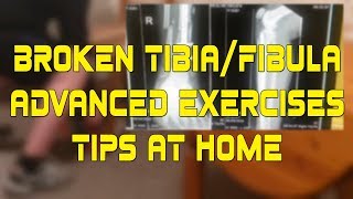 Broken TibiaFibula  Update amp Advanced Exercises [upl. by Ahsaele]