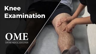 Knee Examination  Orthopaedics [upl. by Pahl335]