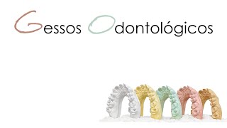 Gessos Odontológicos [upl. by Karin184]