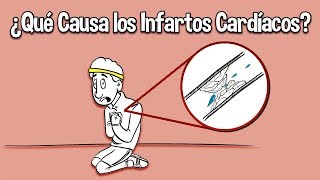 ¿Que Causa los Infartos Cardiacos [upl. by Iatnwahs]