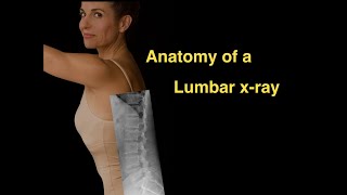 Anatomy of a Lumbar xray [upl. by Box]