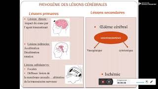 Traumatisme cranien Pr Daoud [upl. by Covell365]